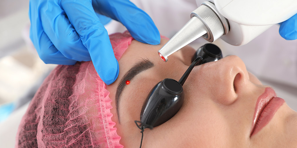 eliminar una micropigmentación de cejas en Madrid