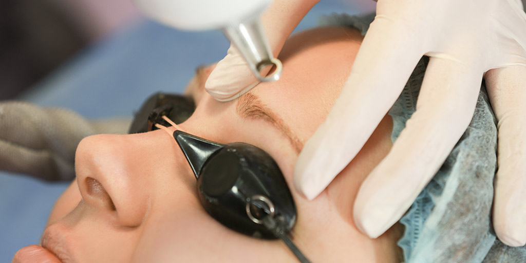 eliminar una micropigmentación de cejas